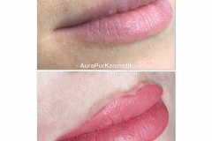 lippenpigmentierung